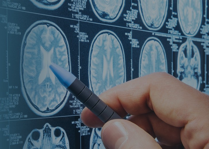 AI Quality Control for MRI and CT imaging